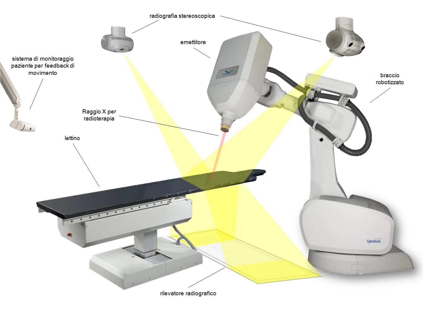 CyberKnife robotic radiosurgery system